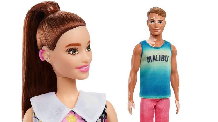 Barbie con vitíligo y prótesis de piernas... ¡Mattel presenta nuevas muñecas!
